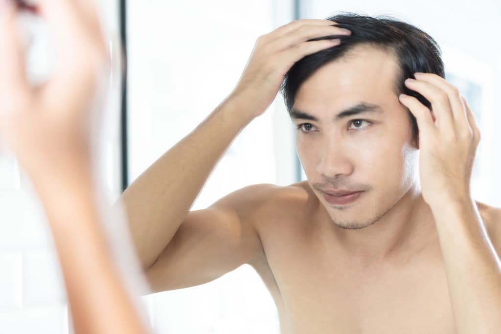 Haartransplantation: Ein Schritt zu dauerhafter Haarfülle
